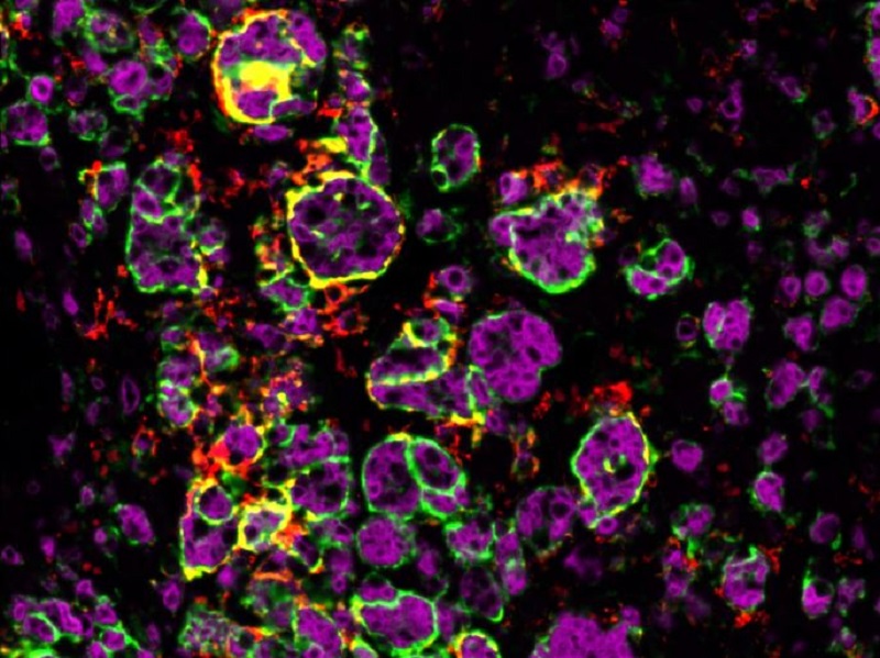 Macrophages attaquant la tumeur surrnalienne dune souris m?le. ? Julie Olabe CNRS/GReD